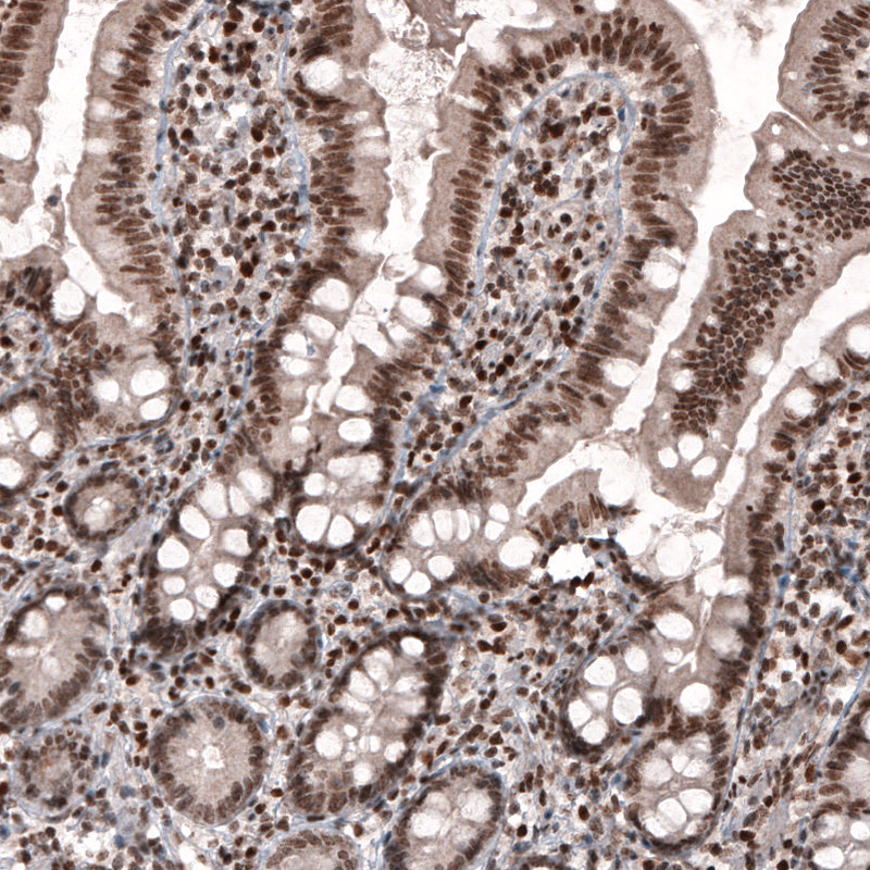 Atlas Antibodies Anti-SMCHD1 Antibody