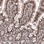 Atlas Antibodies Anti-SMCHD1 Antibody