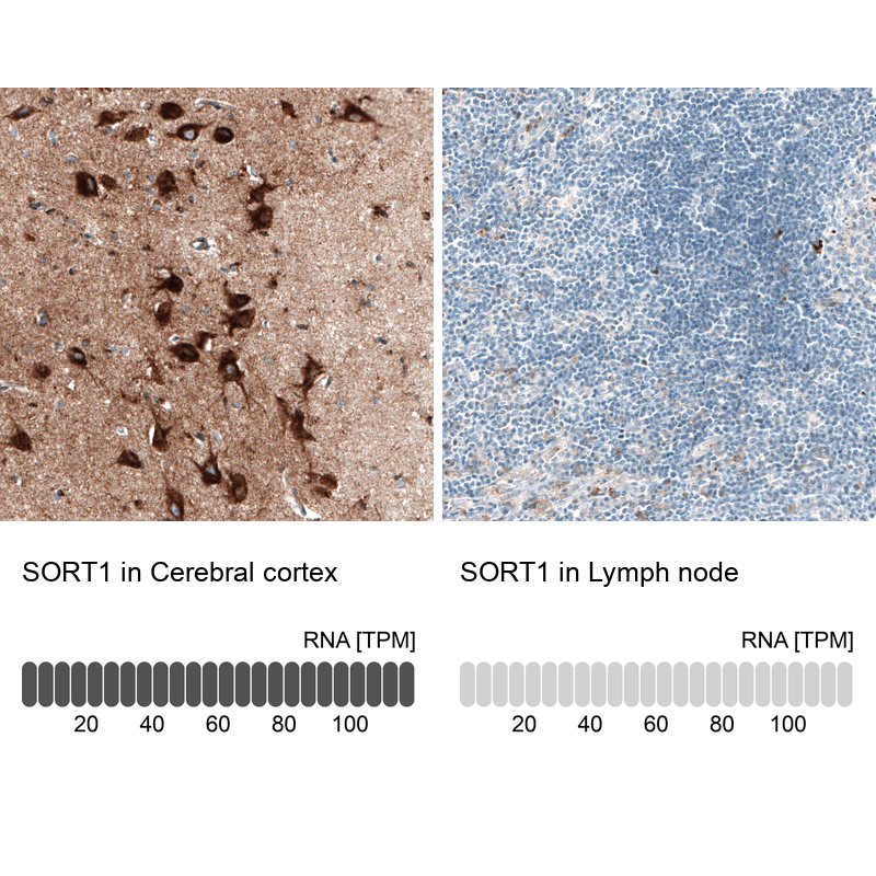 Atlas Antibodies Anti-SORT1 Antibody