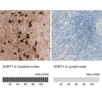 Atlas Antibodies Anti-SORT1 Antibody