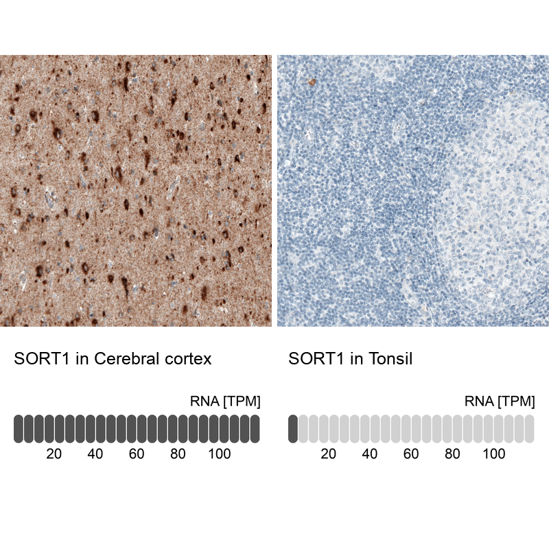 Atlas Antibodies Anti-SORT1 Antibody