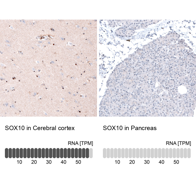 Atlas Antibodies Anti-SOX10 Antibody
