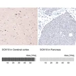 Atlas Antibodies Anti-SOX10 Antibody