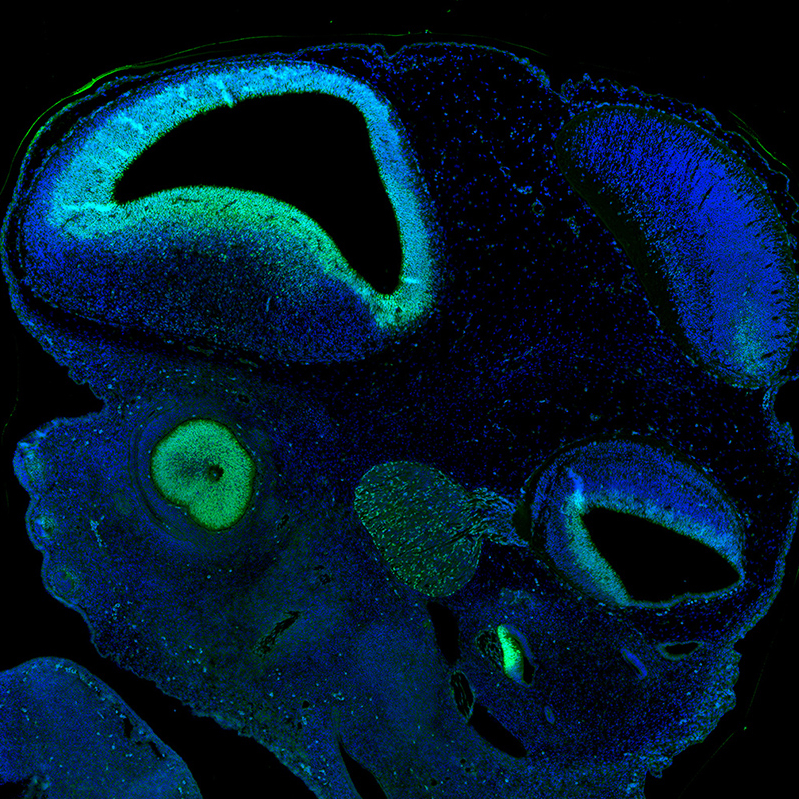 Atlas Antibodies Anti-SOX2 Antibody