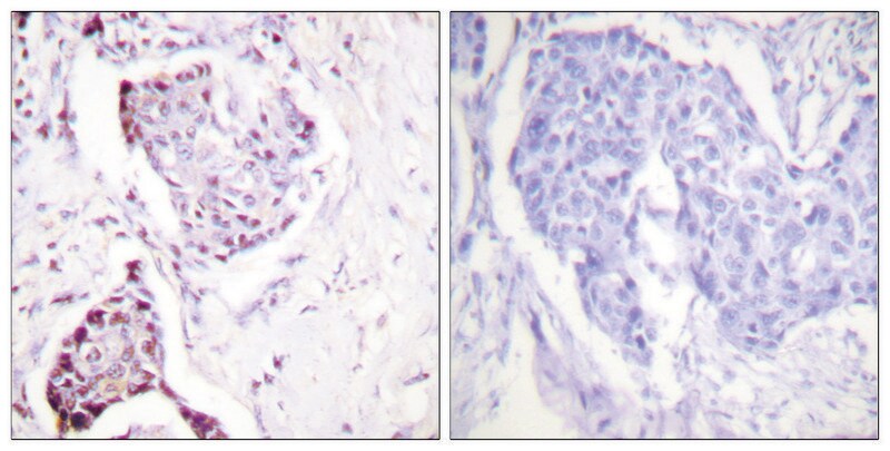 Merck Anti-Ubiquitin antibody produced in rabbit