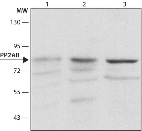 Merck Anti-PP2A subunit B isoform B56-delta antibody, Mouse monoclonal