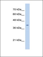 Merck Anti-ST6GALNAC6