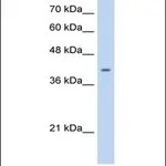 Merck Anti-ST6GALNAC6