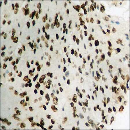 Merck Anti-phospho-STAT1 (pSer727) antibody produced in rabbit