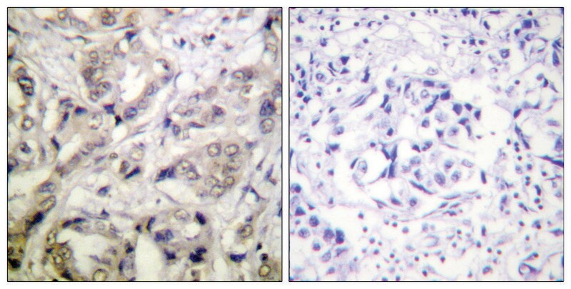 Merck Anti-CAMK1-alpha antibody produced in rabbit