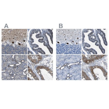 Merck Anti-STIM1 antibody produced in rabbit