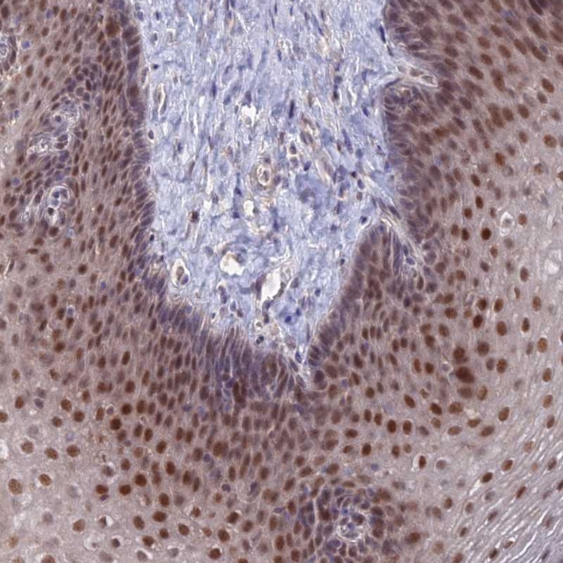 Atlas Antibodies Anti-ZUFSP Antibody