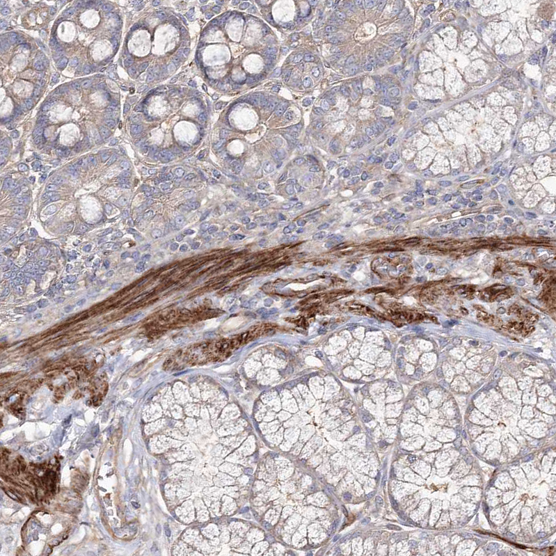 Atlas Antibodies Anti-ZSWIM6 Antibody