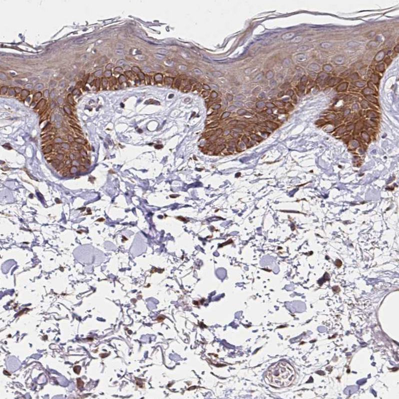 Atlas Antibodies Anti-ZW10 Antibody
