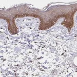 Atlas Antibodies Anti-ZW10 Antibody