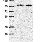 Atlas Antibodies Anti-ZXDC Antibody