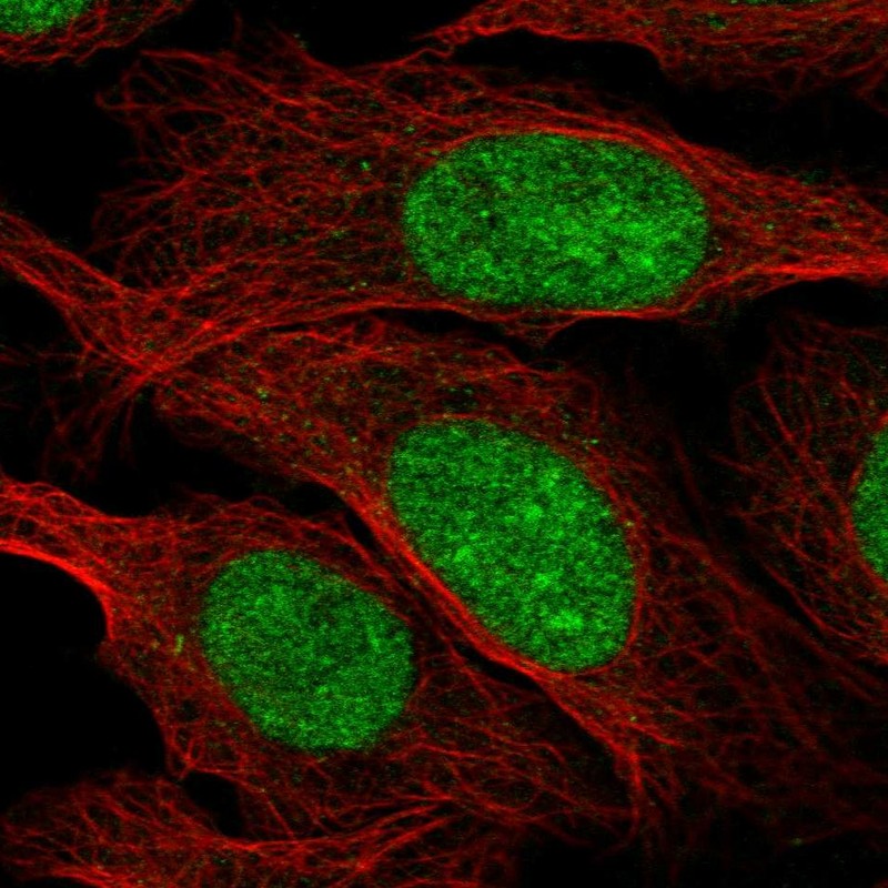 Atlas Antibodies Anti-ZZZ3 Antibody
