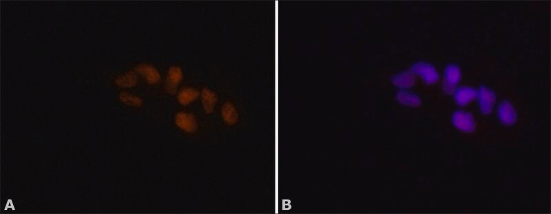 Merck Anti-ADAR1 antibody produced in rabbit