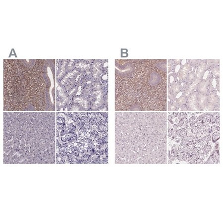 Merck Anti-SFRP4 antibody produced in rabbit