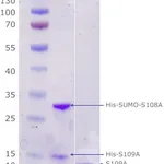 Merck Calprotectin,human recombinant
