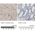 Merck Anti-CNDP1 antibody produced in rabbit