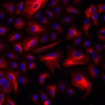 Thermo Fisher Scientific Donkey anti-Rabbit IgG (H+L) Highly Cross-Adsorbed Secondary Antibody, Alexa Fluor Plus 555