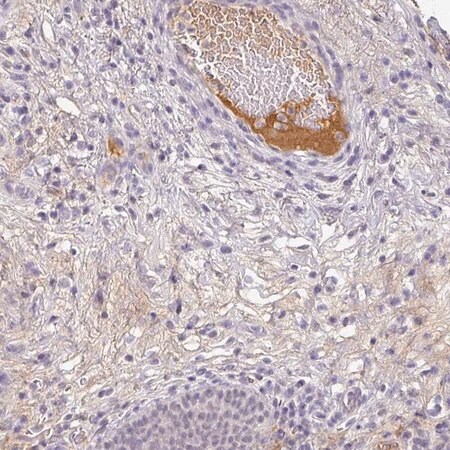 Merck Anti-C1QB antibody produced in rabbit
