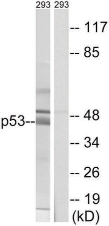Merck Anti-p53 antibody produced in rabbit