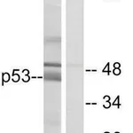 Merck Anti-p53 antibody produced in rabbit