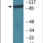 Merck ANTI-PHOSPHO-IL-4R/CD124 (PTYR497)