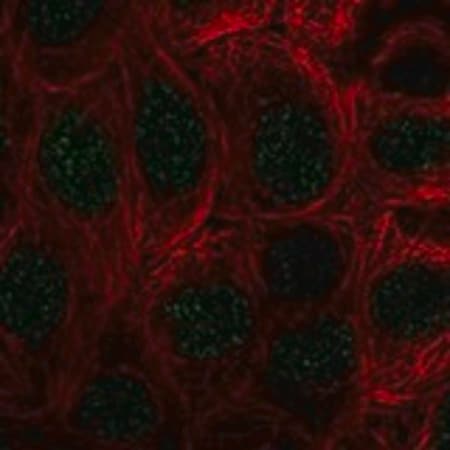 Merck Anti-COMMD10 antibody produced in rabbit