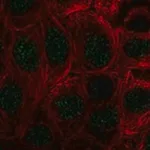 Merck Anti-COMMD10 antibody produced in rabbit