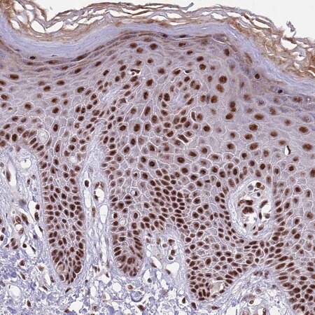 Merck Anti-THOC2 antibody produced in rabbit