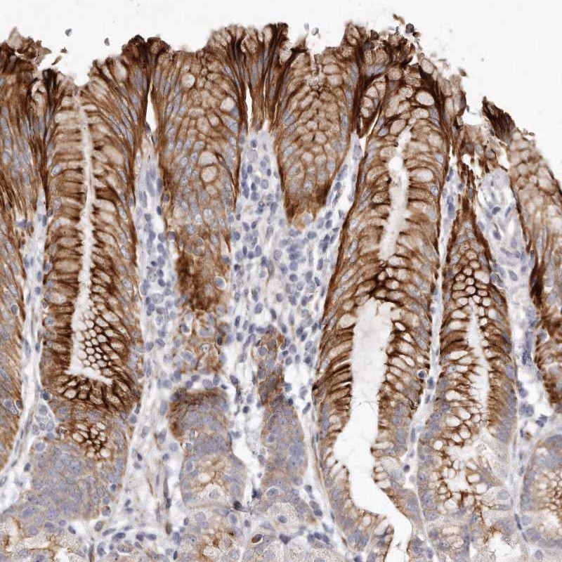 Atlas Antibodies Anti-ZYG11A Antibody