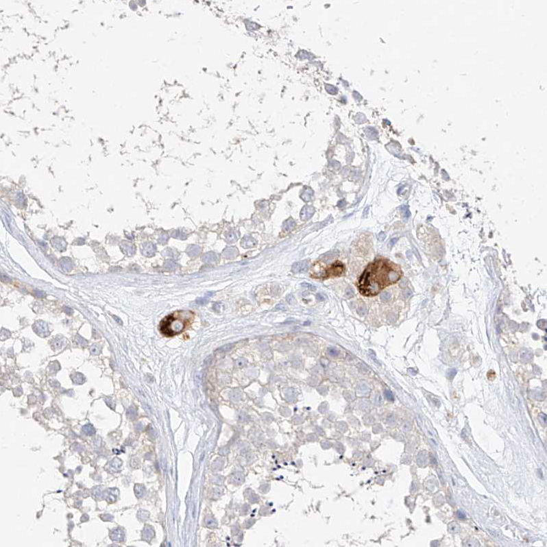Atlas Antibodies Anti-ZZEF1 Antibody