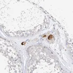 Atlas Antibodies Anti-ZZEF1 Antibody