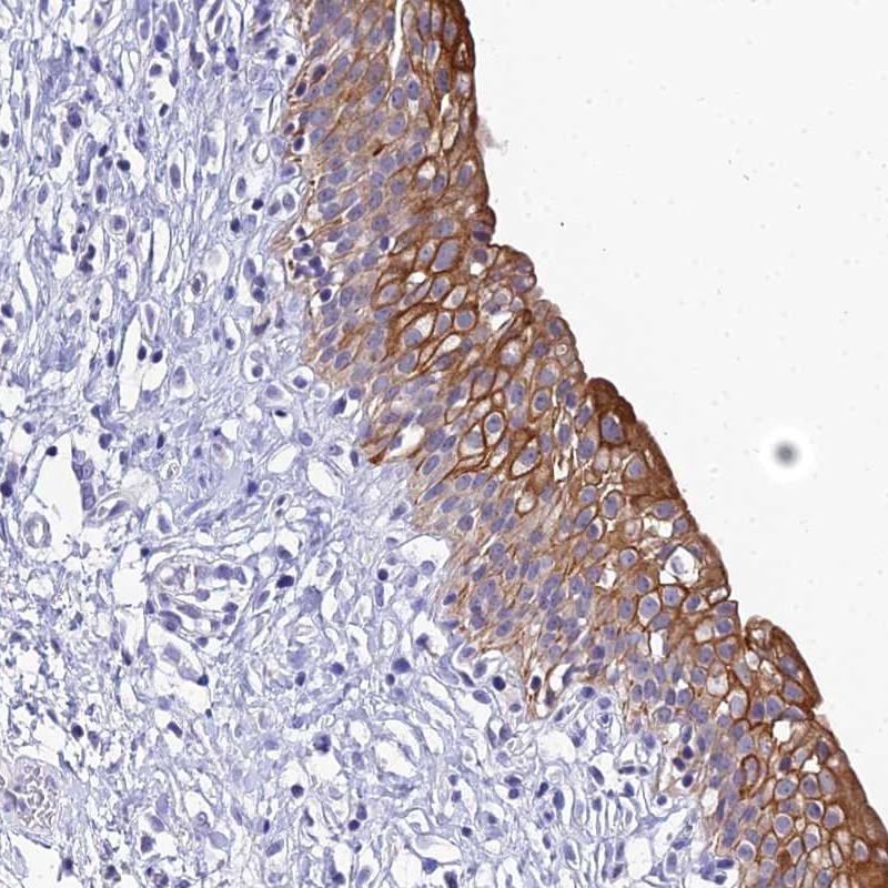 Atlas Antibodies Anti-ZXDB Antibody