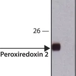 Merck Anti-Peroxiredoxin 2 (C-terminal) antibody produced in rabbit
