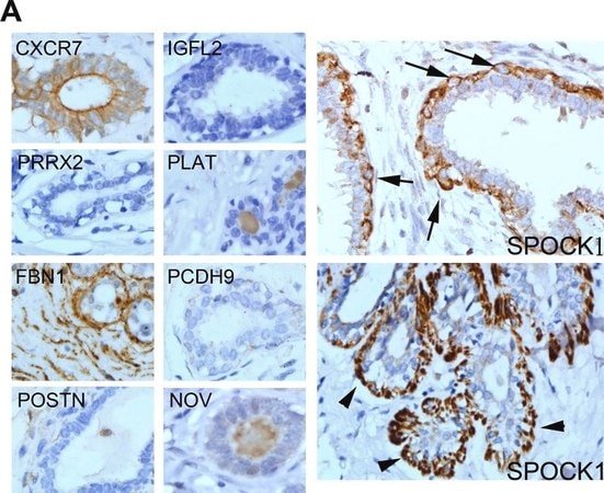 Merck Anti-ACKR3 antibody produced in rabbit