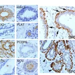 Merck Anti-ACKR3 antibody produced in rabbit