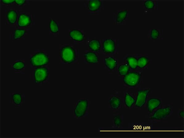 Merck Monoclonal Anti-USP14 antibody produced in mouse