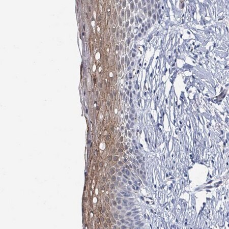Merck Anti-DCAF5 antibody produced in rabbit