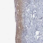 Merck Anti-DCAF5 antibody produced in rabbit