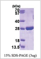 Merck GSTP1, HUMAN