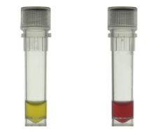Kisanbio Arabitol Test