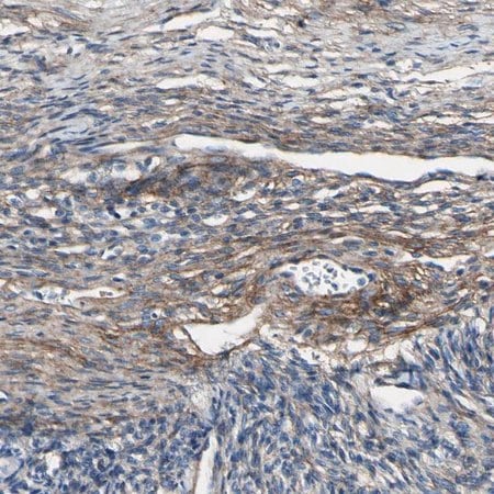Merck Anti-COL6A3 antibody produced in rabbit