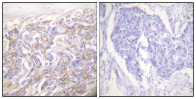 Merck Anti-TNF Receptor I antibody produced in rabbit