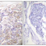 Merck Anti-TNF Receptor I antibody produced in rabbit