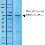 Merck PSEUDOMONAS EXOTOXIN A FROM PSEUDOMONAS