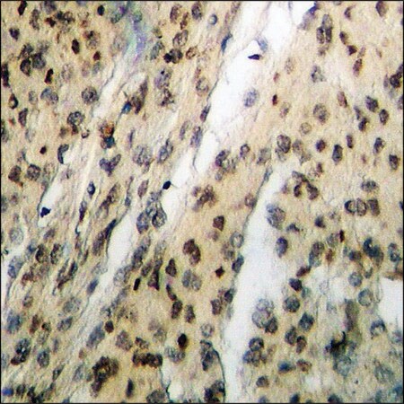 Merck Anti-phospho-Chk1 (pSer317) antibody produced in rabbit
